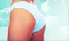 $149 for Four SmoothShapes Cellulite-Reducing Treatments at Advanced Laser Clinic ($1,000 Value)