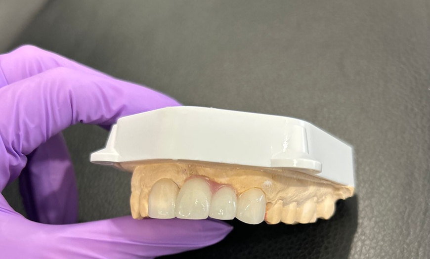 Image 3: Comprehensive Dental Check-up With X-Rays and Polish Included