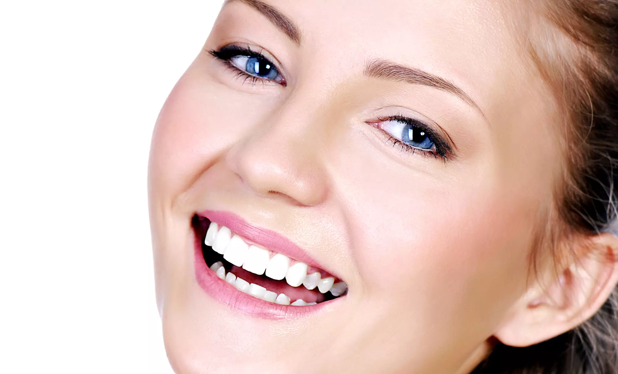 Opalescence Teeth-Whitening Treatment with Optional Custom Trays and Gel at Comfort Dental (Up to 67% Off) - Primary Image