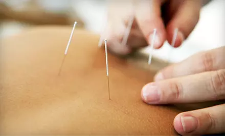 Acupuncture Package for New or Returning Clients at Virginia University of Oriental Medicine in Fairfax (Up to 65% Off)  - Primary Image