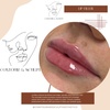 Image 5: Define Your Lips with Expertly Applied 0.5ml or 1ml Dermal Filler 