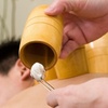 Image 1: Experience Traditional Bamboo Cupping with a One or ThreeSessions!
