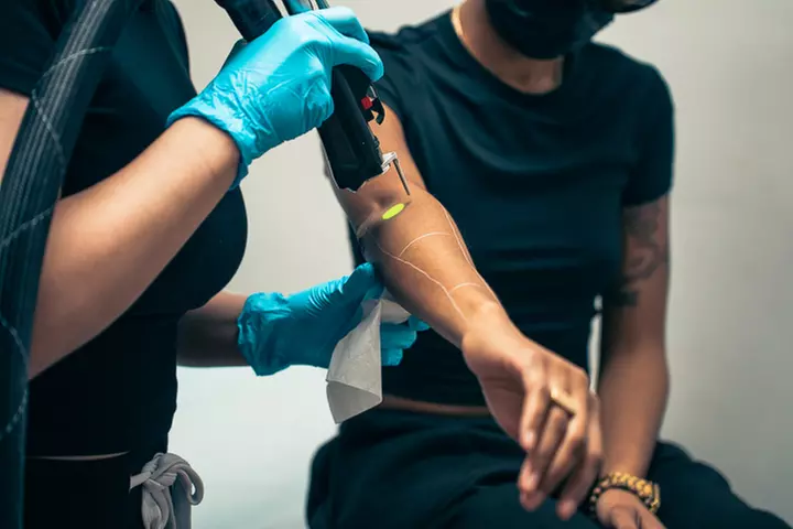 Laser Hair Removal Treatments at Laser Bar & Spa