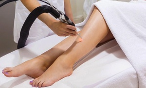 Six Laser Hair-Removal Sessions on Small Area, Medium and Large Area