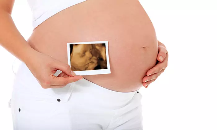 Take an Early Peek at Your Baby with Premium 4D Baby Scan at Window to the Womb (Up to 34% Off) - Primary Image