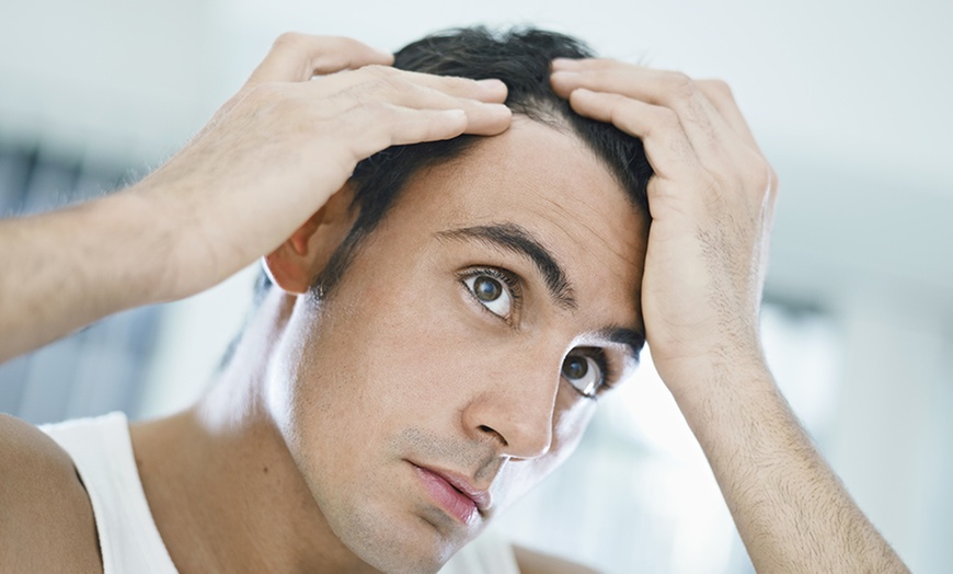 Image 1: PRP Hairloss Treatment Tailored Just for You!