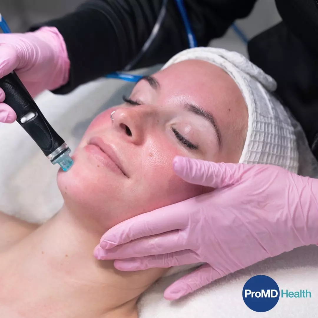 Rejuvenate Your Skin with Signature Hydrafacial at ProMD Health (Columbia) (Up To 24% Off) - Primary Image