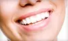 Two, Four, or Six Veneers from Valerie Barba, DDS, in Mansaquan (Up to 74% Off)