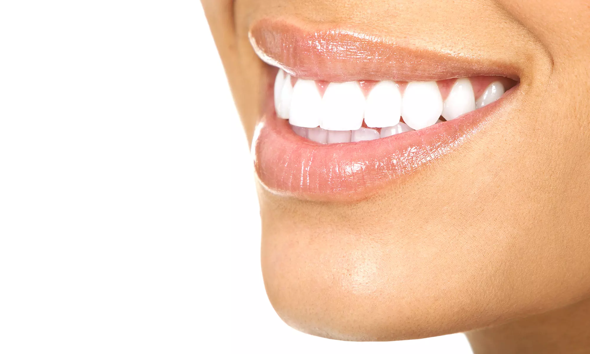 $99 for a 12-Month Private-Care Savings Program at Advanced Dentistry of Charlotte ($795 Value) - Primary Image