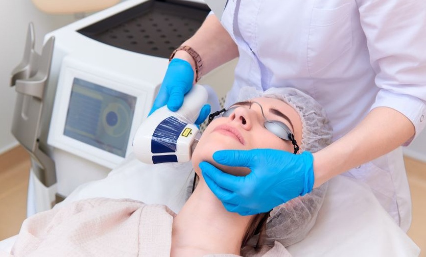 Image 9: 1 o 3 sesiones de láser para fotorejuvenecimiento y opción a peeling
