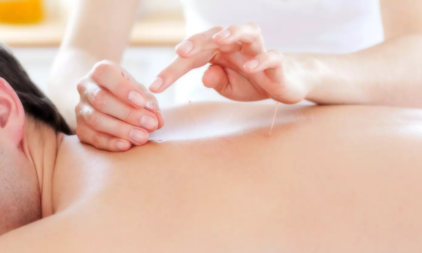 One or Three Acupuncture Treatments with Initial Consultation at To The Point Acupuncture Center (Up to 71% Off) - Primary Image