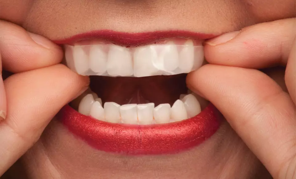 $18 for a 10-Pack of Sheer White! 20% Professional Teeth-Whitening Strips ($60 List Price). Free Shipping. - Second Medium