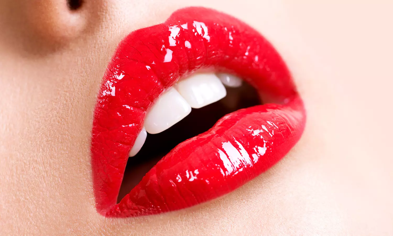 Mesotherapy for Lip Volume at Miami Kiss