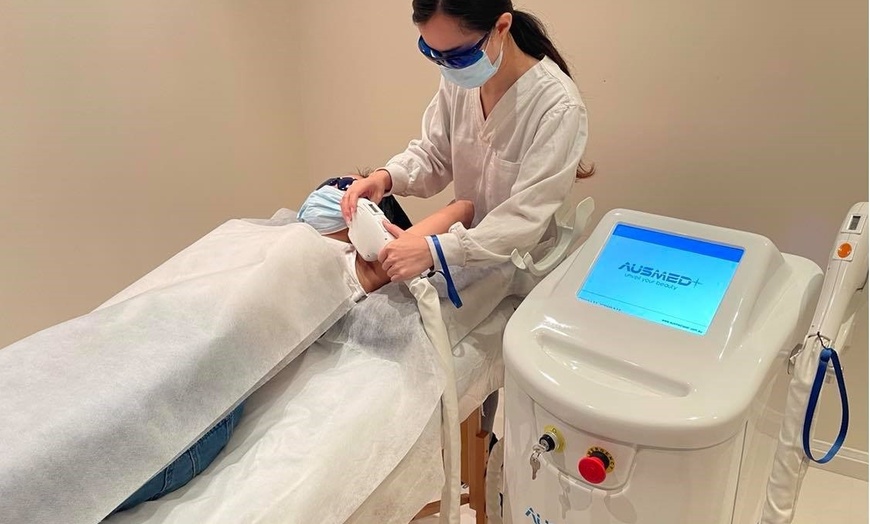 Image 1: Three Sessions SHR Laser Hair Removal
