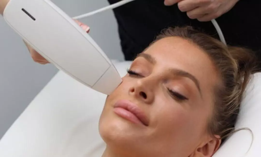 Rejuvenate with Micro Needling and Nanofractional PRP