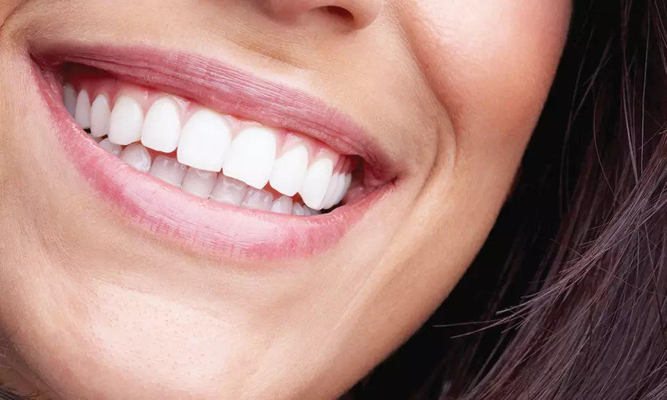 $39 for $1,500 Value for Invisalign at Dental Square - Primary Image