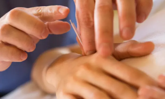 $23 for Two Acupuncture Treatments at Acupuncture For All ($60 Value)  - Primary Image