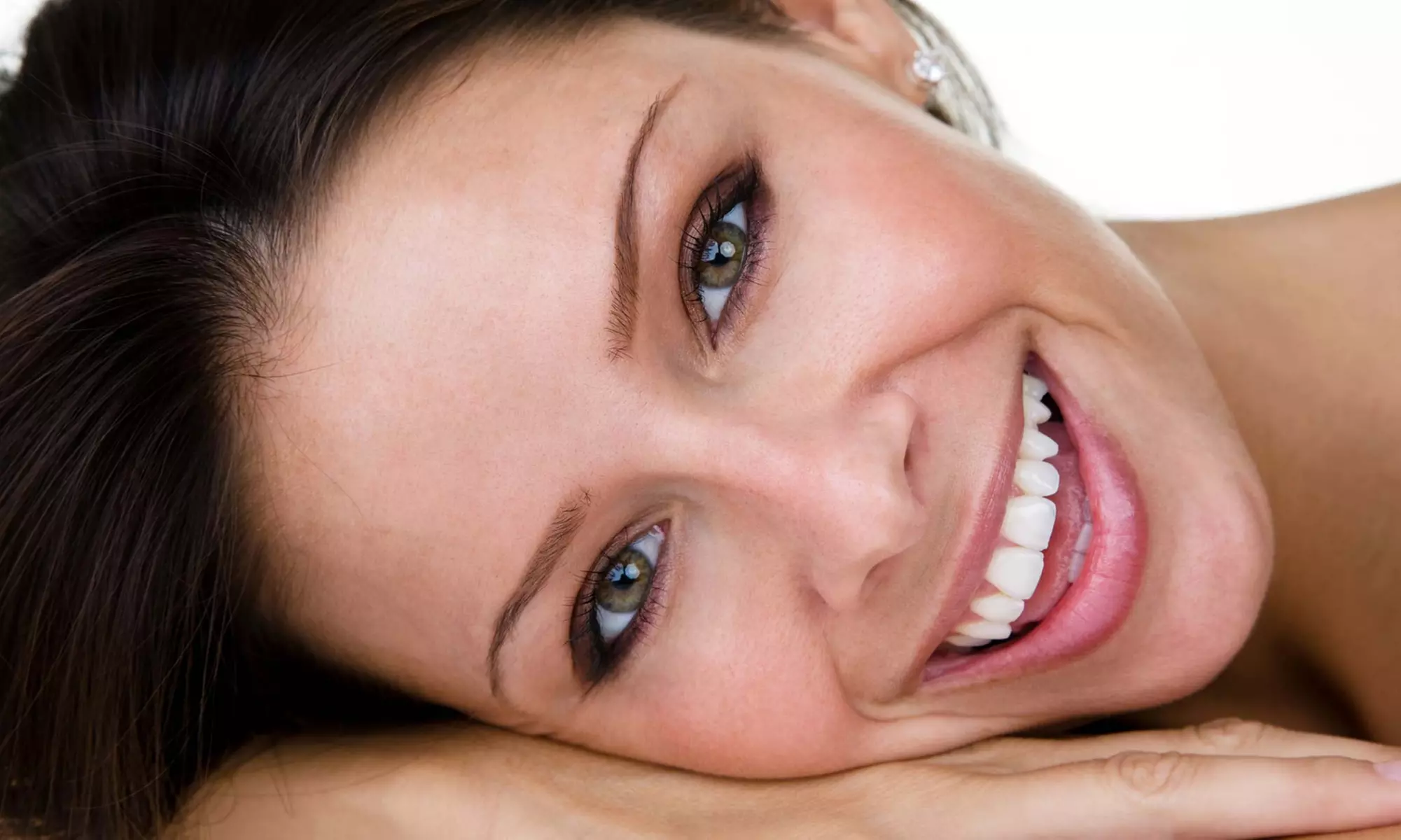 $199 for $2,000 Toward Invisalign with Complete Exam and X-rays at Twin Cities Dental ($2,187 Value) - Primary Image