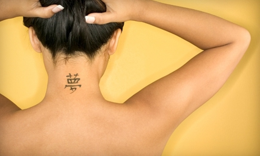 The 10 Most Frequently Asked Questions about Laser Tattoo Removal 