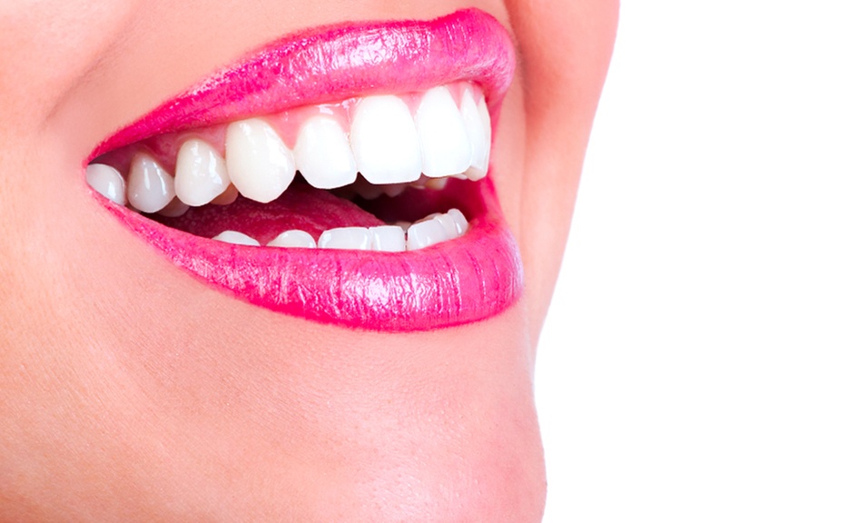 Férula de bruxismo con limpieza bucal en Clínica Futuredent