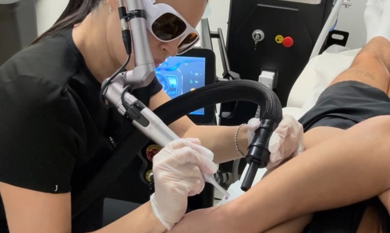 Precise and advanced laser tattoo removal with expert care