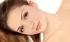 One or Three Microdermabrasion Treatments at LCI Lasercom Clinics (Up to 62% Off)