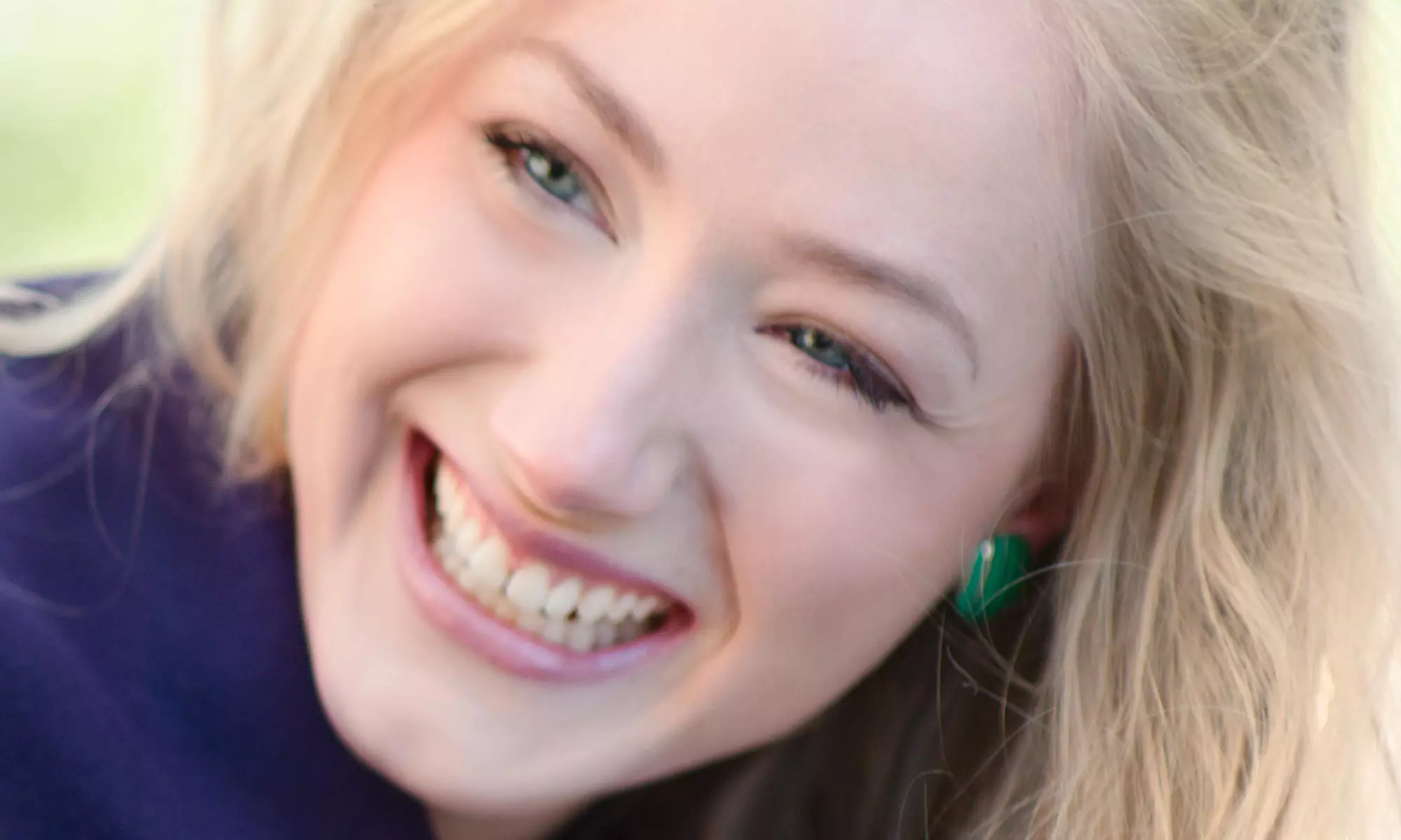 Dental Checkup Package with Optional Take-Home Teeth-Whitening Kit at Broadway Dental (Up to 83% Off) - Primary Image