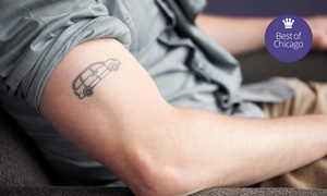 Up to 63% Off Tattoo Removal