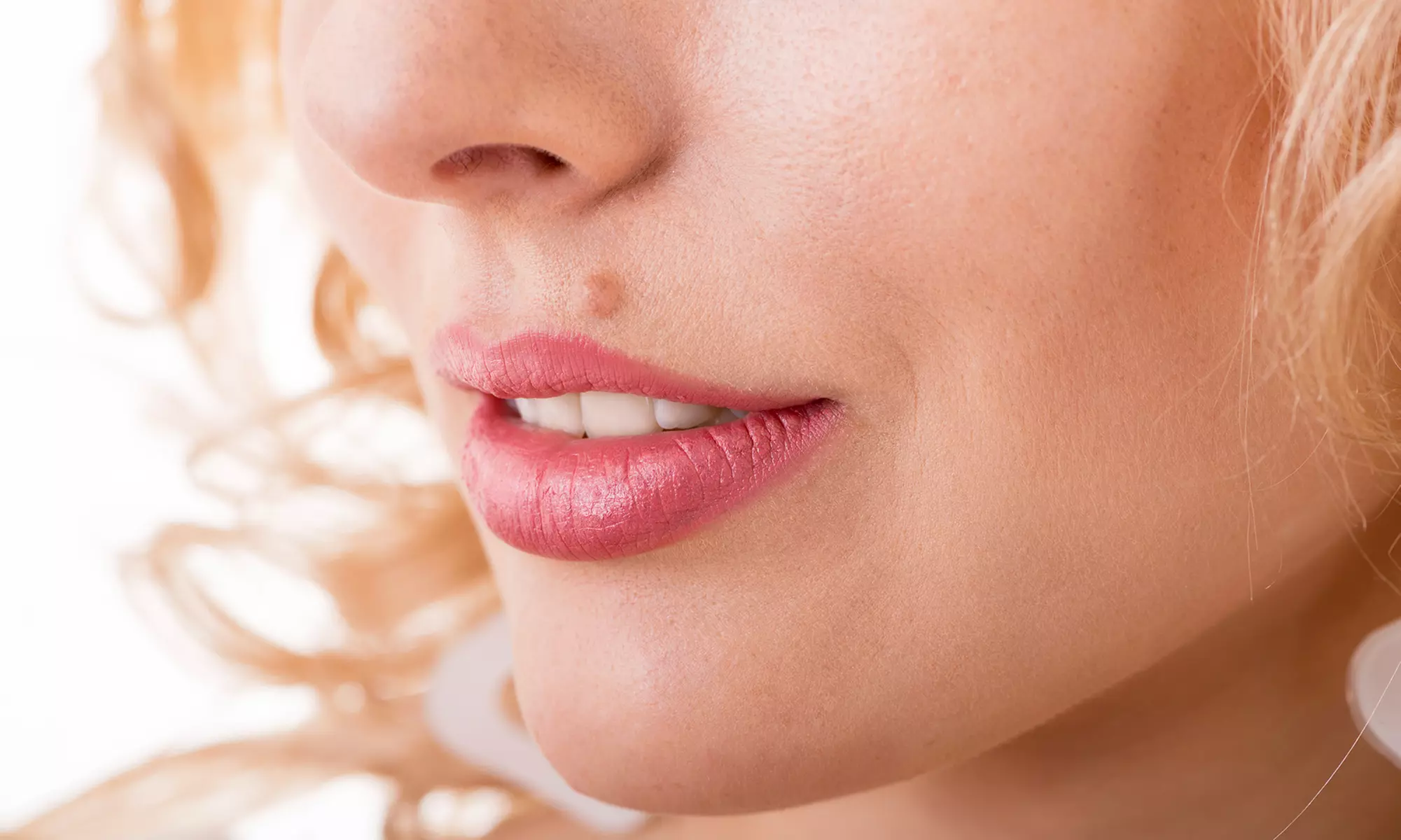 Rehidratación o infiltración de relleno dérmico en labios o rostro en Baobá - Primary Image