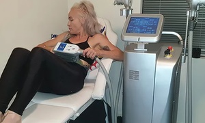 360-Degree Fat Freezing Session