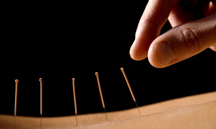 Acupuncture East - Acupuncture Acupressure Points