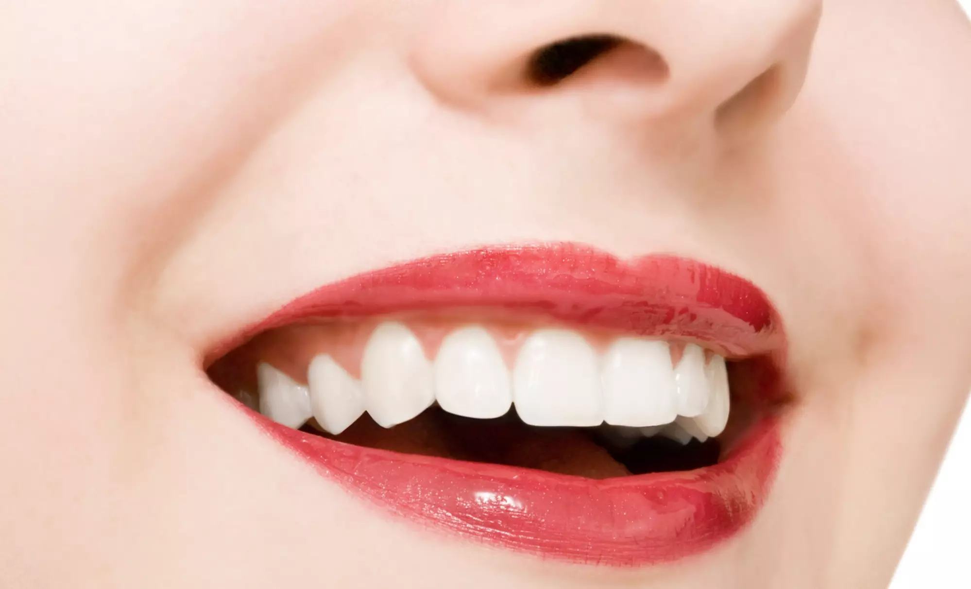 Dental Exam with X-Rays and Cleaning or Teeth-Whitening Treatment at Confident Smile (Up to 82% Off) - Primary Image