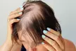Revitalize Your Hair with Microscopic Analysis and Scalp Detox at Drstrandz ( Up to 50% Off ) - Second Medium