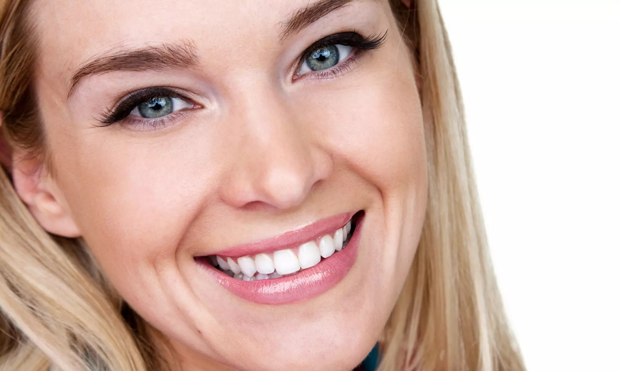 Dental Checkup with Optional Take-Home Whitening from iSmile Family Dental Centers (Up to 90% Off) - Primary Image
