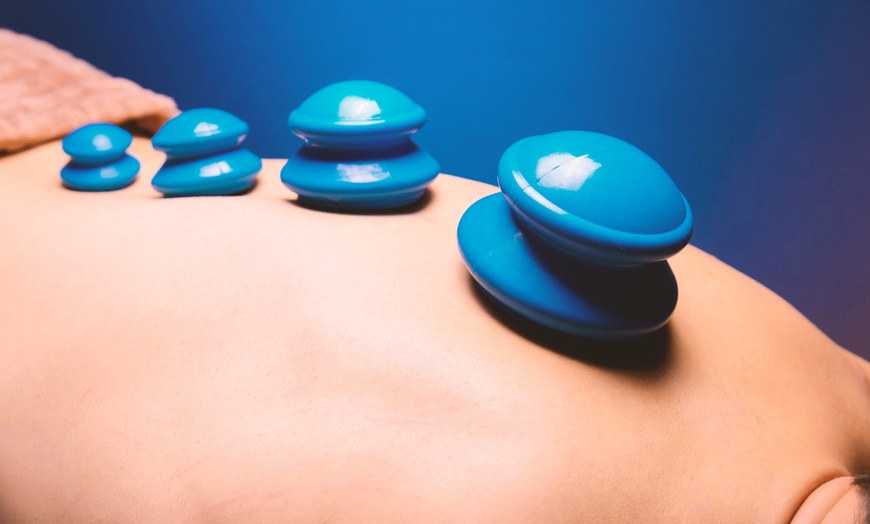 Image 4: Acupuncture with Cupping, Community Sessions or LED Red Light Options