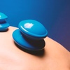 Image 4: Acupuncture with Cupping, Community Sessions or LED Red Light Options