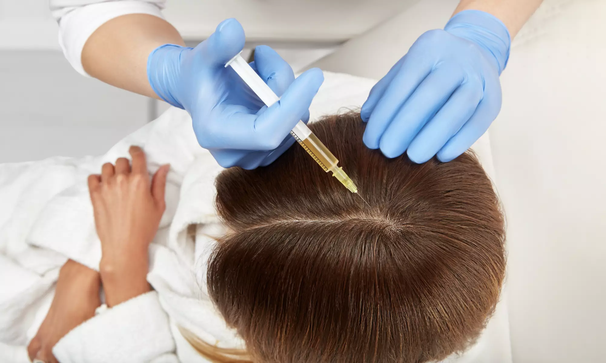 Up to 10% Off on Hair Restoration - Non-Surgical at San Diego Eyelid Specialists - Primary Image