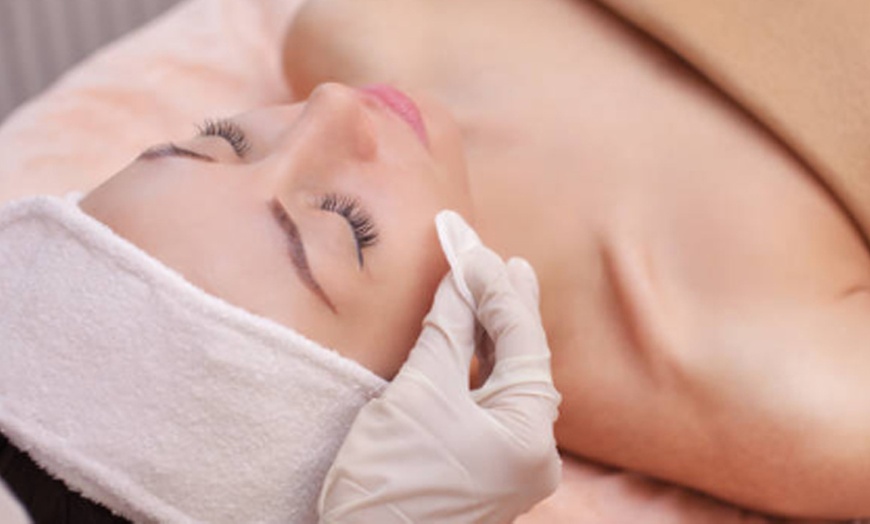 Image 2: Limpieza facial con opción a radiofrecuencia y microdermoabrasión 