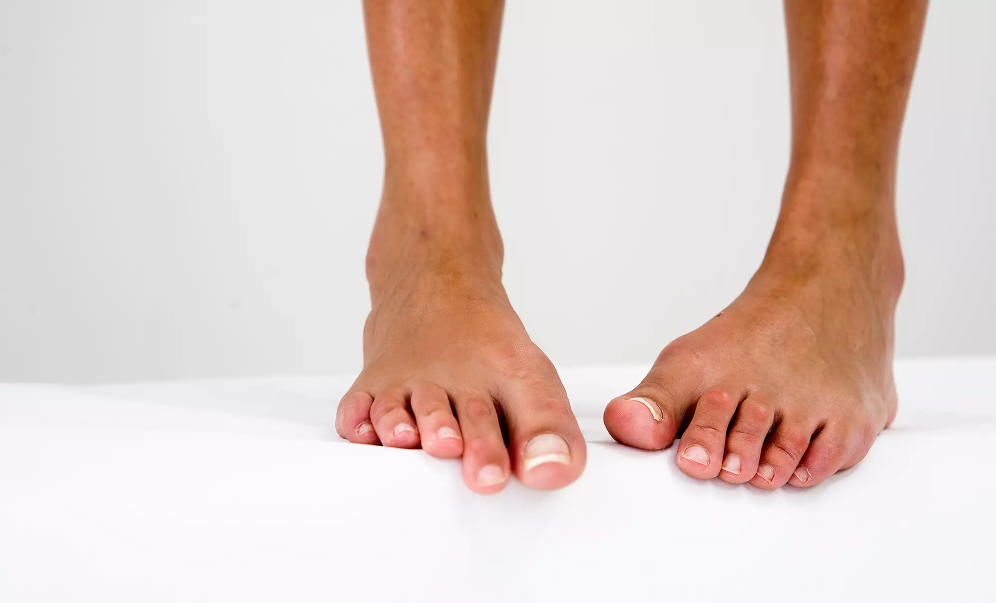 Laser Toenail-Fungus Treatment for Up to 5 or 10 Toes at Carolinas Toenail Laser Centers (Up to 82% Off) - Primary Image