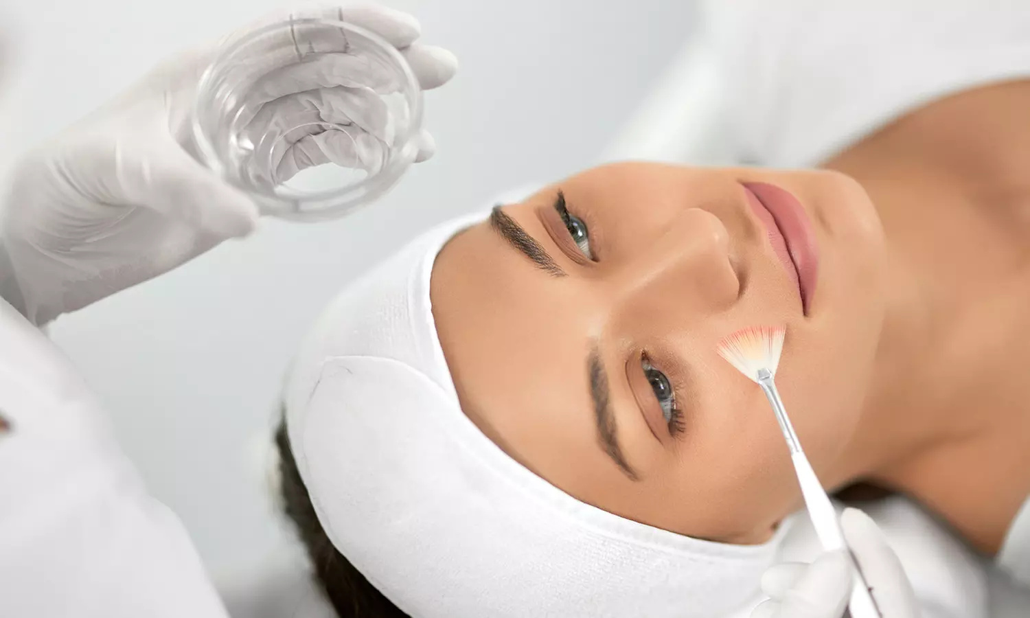 Skin Peel treatment at Miami Kiss
