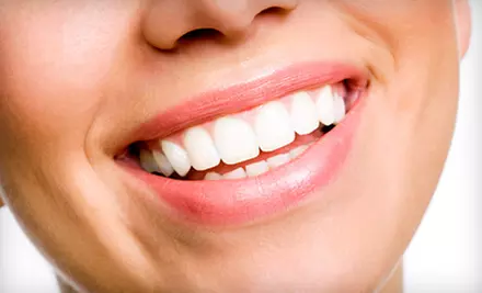 Dental Checkup with Teeth-Whitening Kit or Invisalign Consult at Otay Lakes Dental Group in Chula Vista (Up to 96% Off) - Primary Image