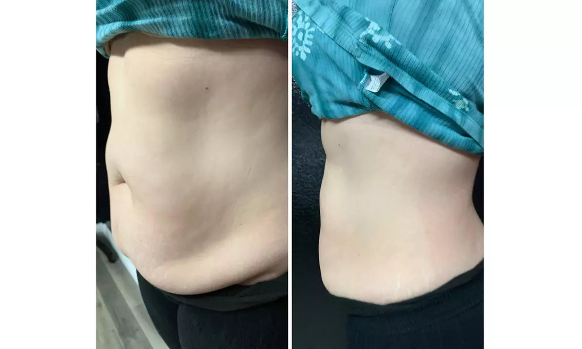 Up to 50% Off on Body Wrap at Me, Myself, & I Industries LLC - Second Medium