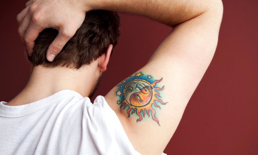 Tattoo removal lets old associations be forgotten