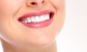 30-Min Teeth Whitening Treatment