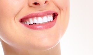 30-Min Teeth Whitening Treatment