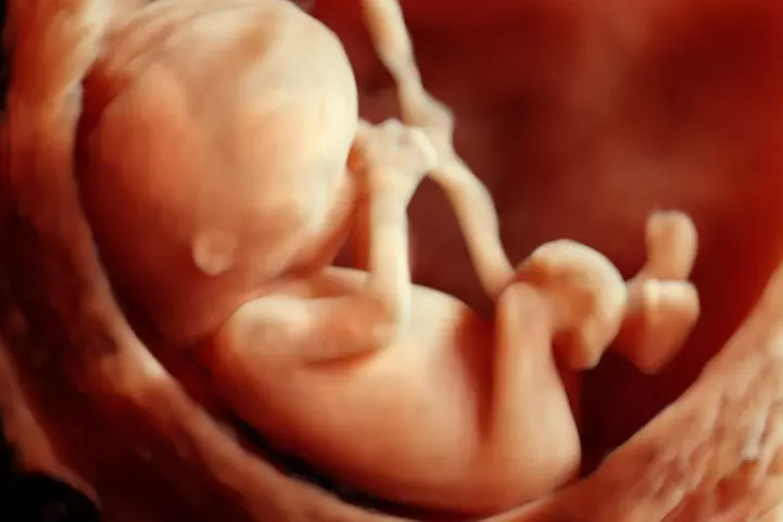 Ultrasound Live Session and Gender Determination Package at New Leaf 4D (Up to 32% Off). Two Options Available. - Primary Image
