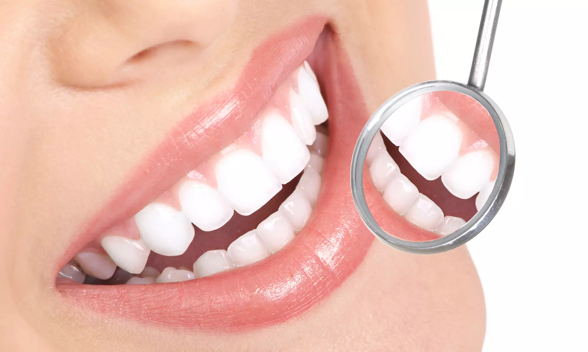 Dental Exam, X-Rays, and Cleaning with Optional Zoom! Whitening from Dr. Joseph Rahabi, DDS (Up to 80% Off) - Primary Image