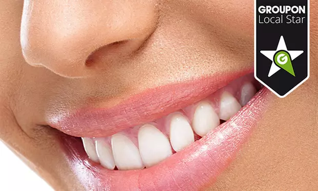 Blanqueamiento dental LED por 59,95 € o añade revisión y limpieza con ultrasonidos por 69,95 € - Primary Image