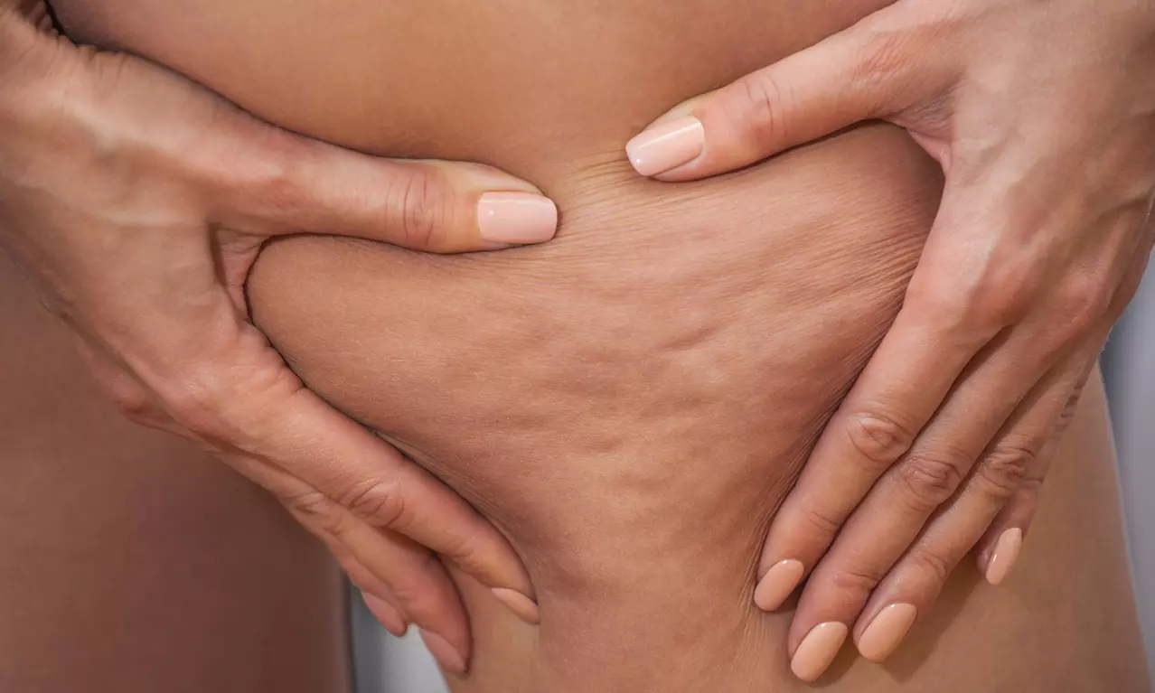 1 a 3 sesiones de mesoterapia corporal con Hyaluron Pen en zona a elegir en BAOBA - Primary Image