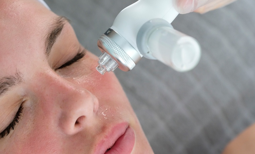 Image 1: Transform Your Skin with the Ultimate HydraFacial 6-in-1 Treatment